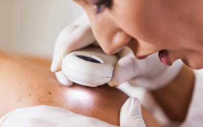 The 3 Major Types of Skin Cancer