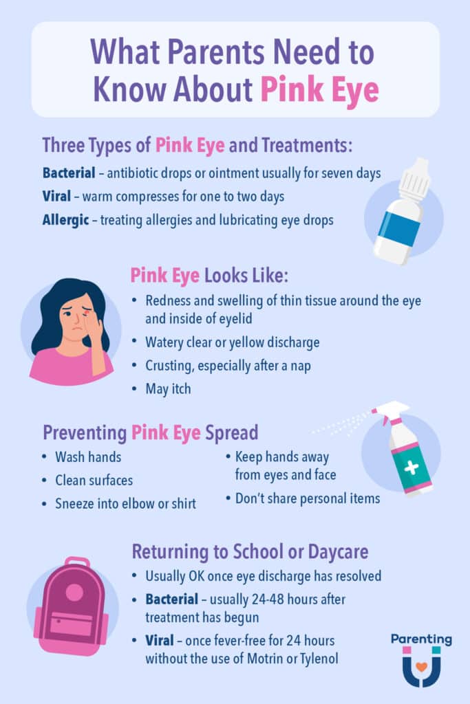 Pink Eye Infographic