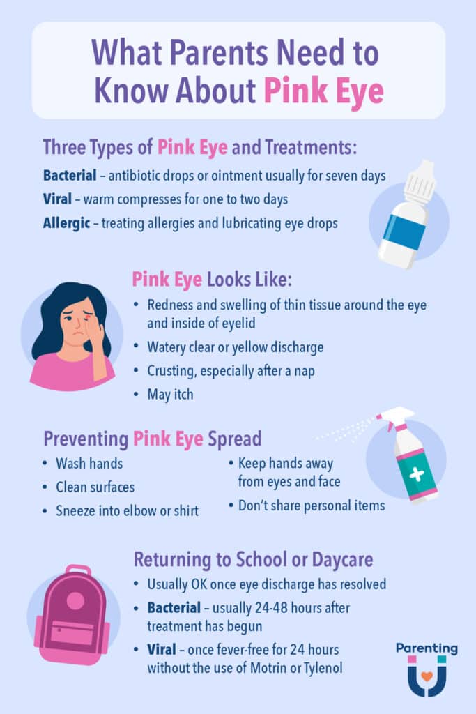 pink eye treatment antibiotic